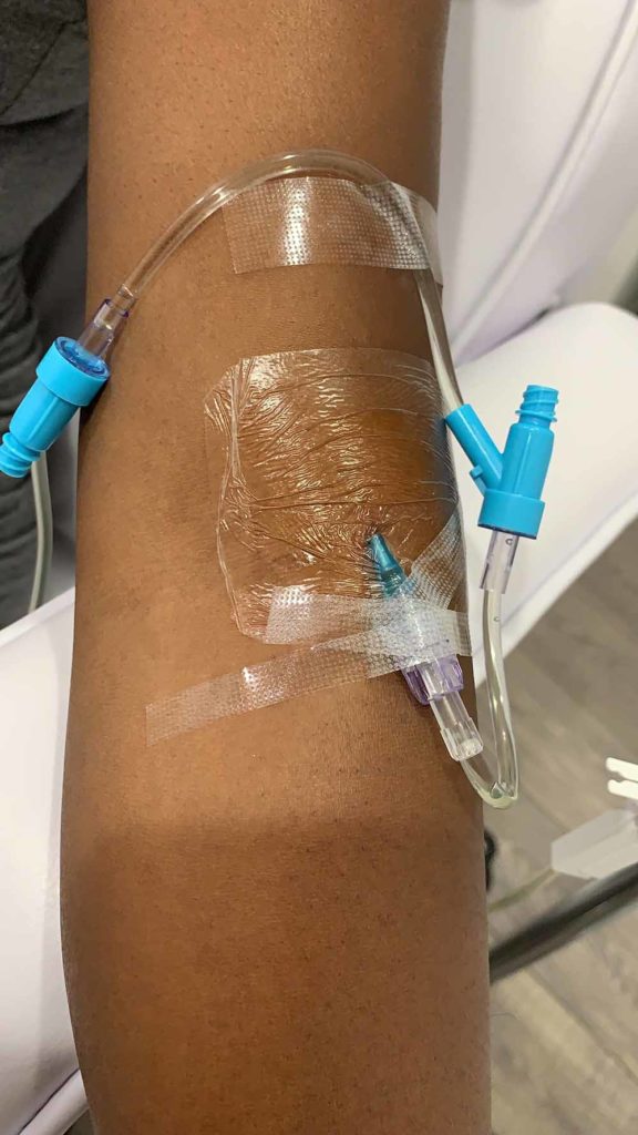 IV Drip The Indigo Clinic